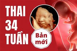 Thai 34 Tuần Nước Ối Bao Nhiêu Là Dư Là Đủ